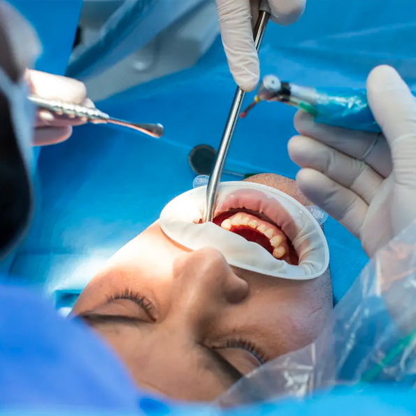CIRUGÍA BUCAL Y MAXILOFACIAL