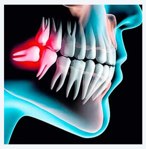 Cirugía Bucal y Maxilofacial en Los Olivos