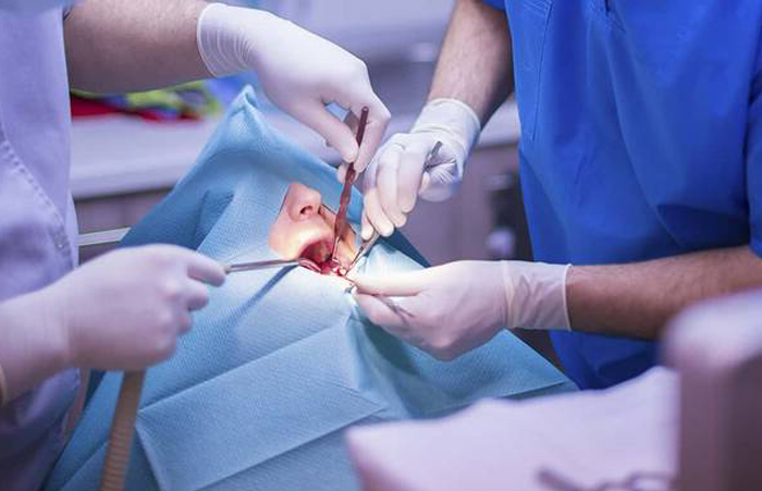 Cirugía Bucal y Maxilofacial en Los Olivos