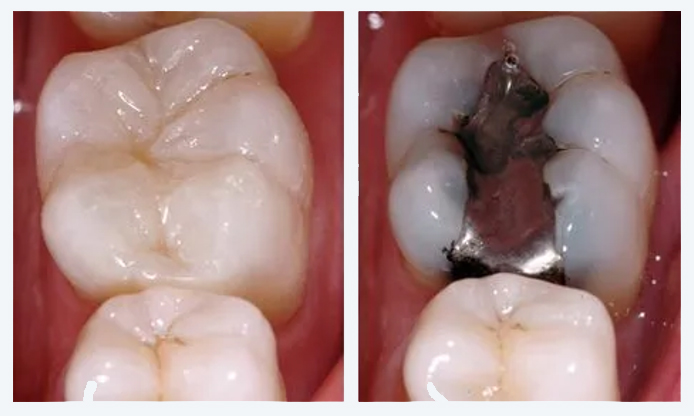 Operatoria Dental