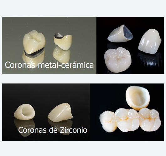 Prótesis Dental en Los Olivos
