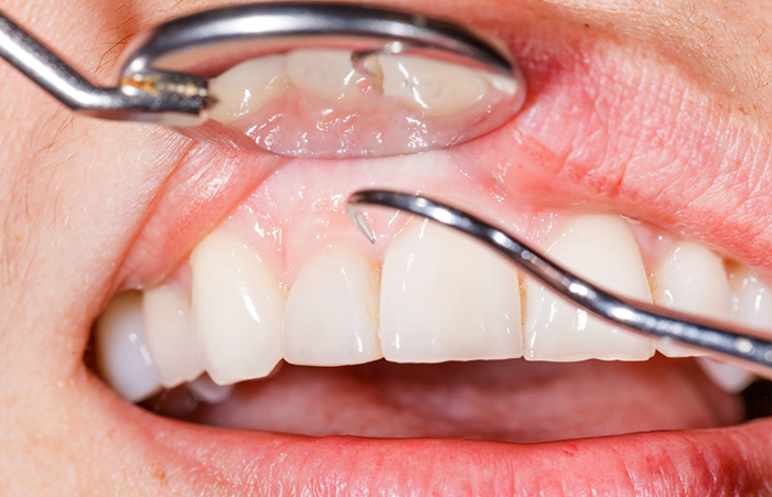 Periodoncia en Los Olivos
